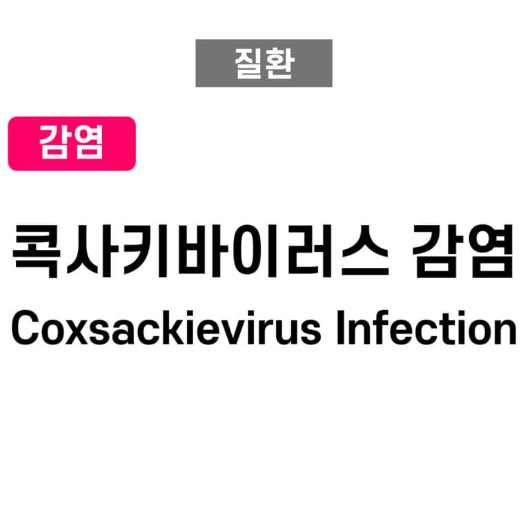 콕사키바이러스 감염 (Coxsackievirus Infection)