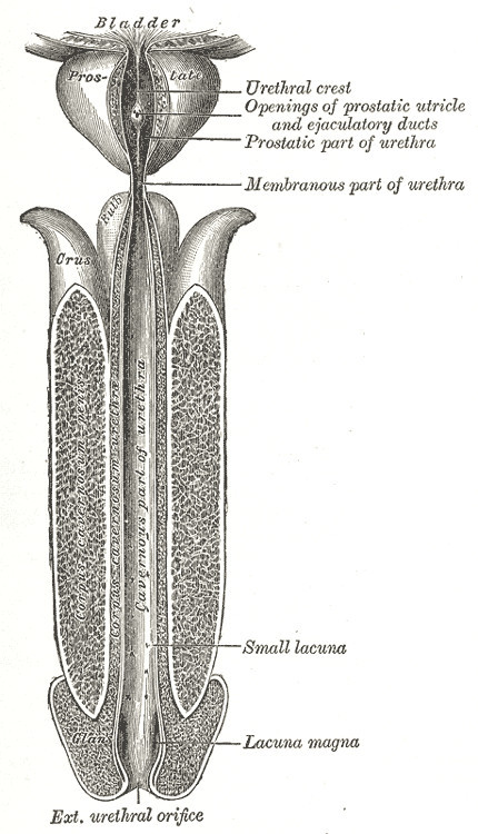요도협착(Urethral Stricture)