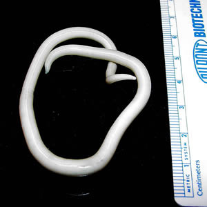 회충 성충(Ascaris lumbricoides)