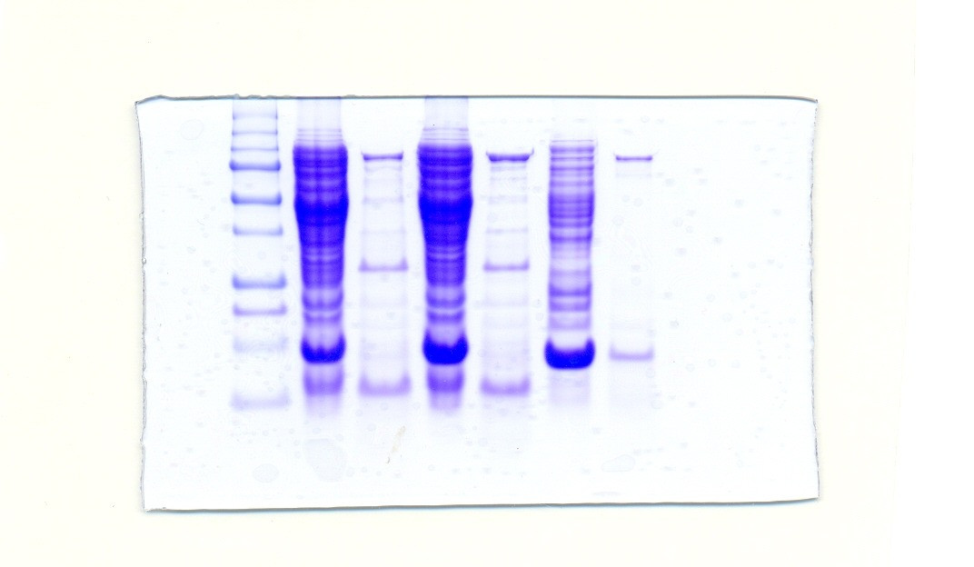 Taq DNA 중합효소의 분자량을 확인한 SDS-PAGE 겔