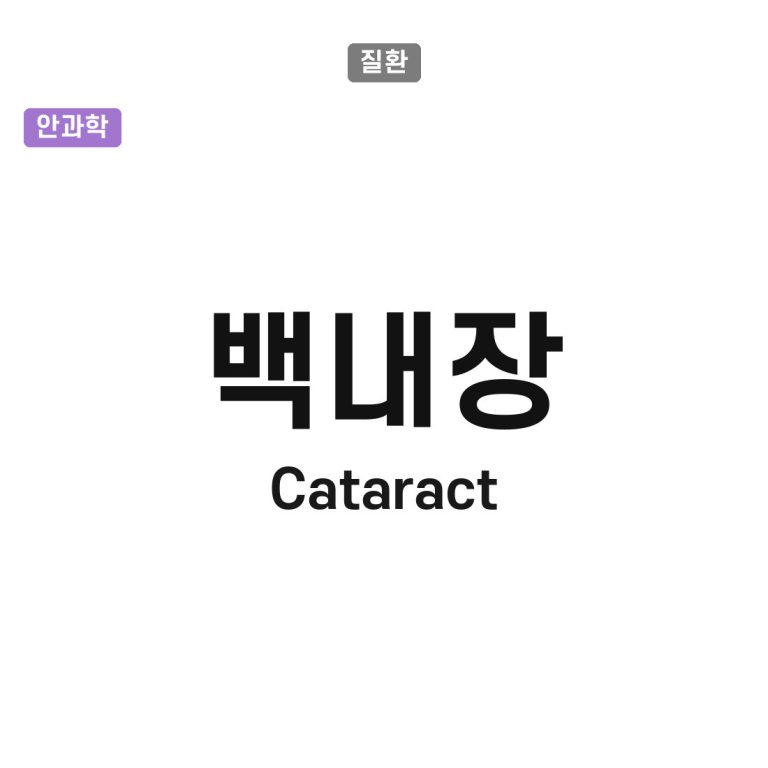 백내장(Cataract)