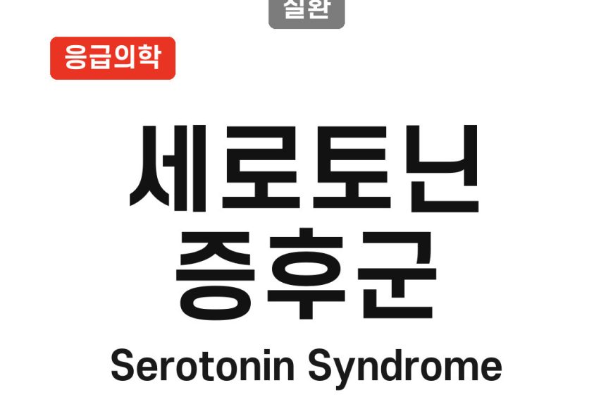 세로토닌 증후군(Serotonin Syndrome)